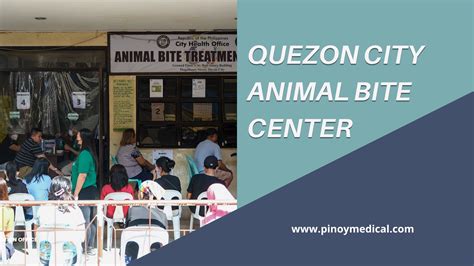 animal bite center manila city hall|CITIZEN CHARTER PASIG ANIMAL BITE TREATMENT CENTER.
